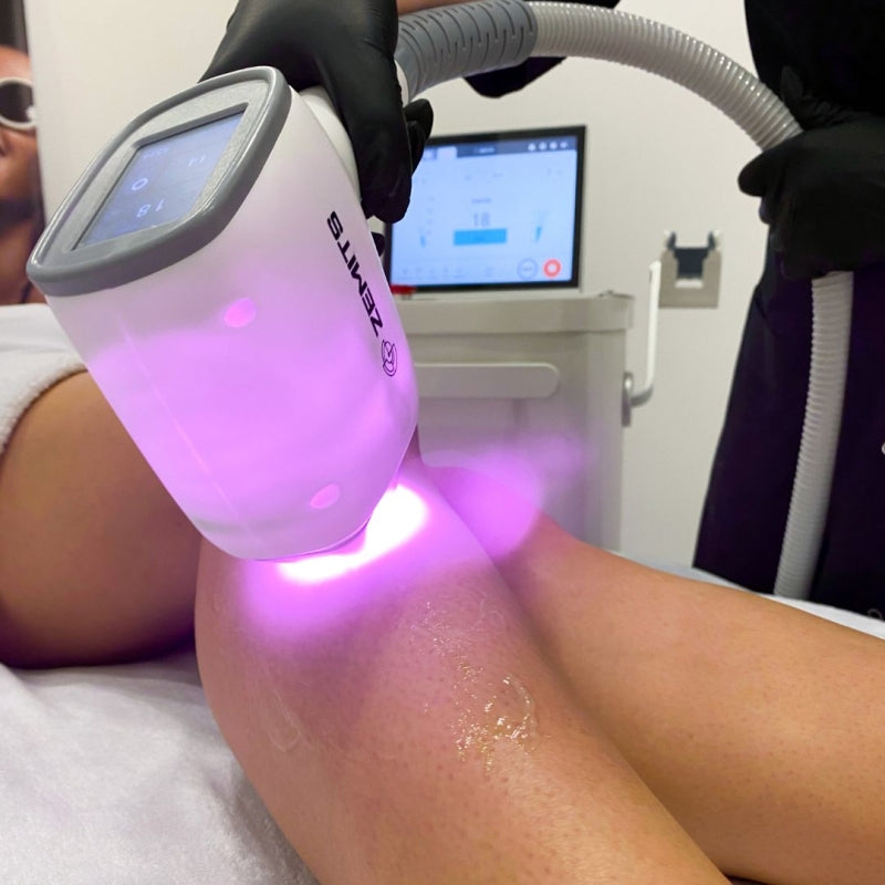 Zemits Quidion Laser de Diodo para Remoção de Pelos